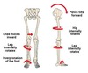 6 Minute Anterior Pelvic Tilt Exercise Routine | PrecisionMovement.coach