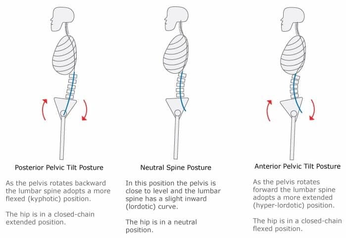 anterior pelvic tilt and posterior pelvic tilt