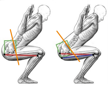 lower back pain from squats pelvic tilt during squats