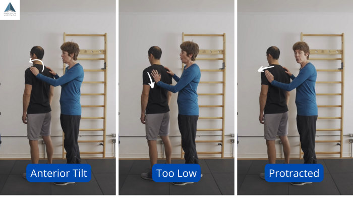 issues with incorrect scapular position (shoulder blade)