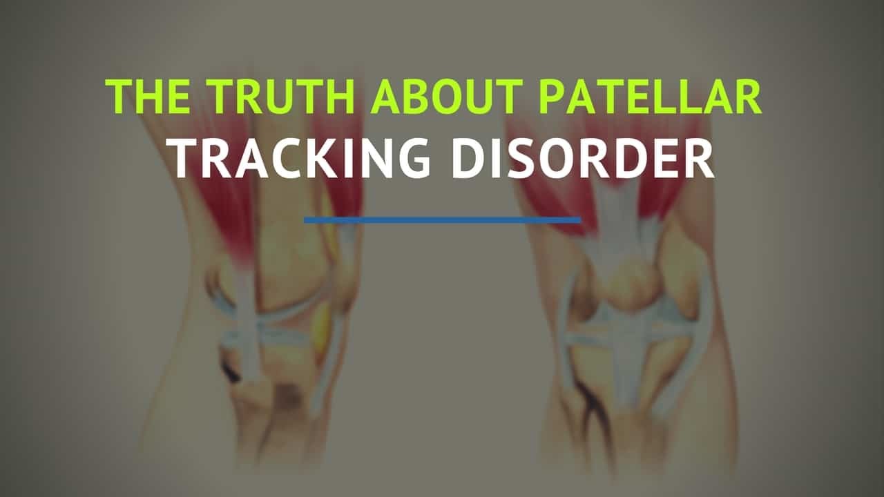 What Is the Patellar Tracking Disorder?