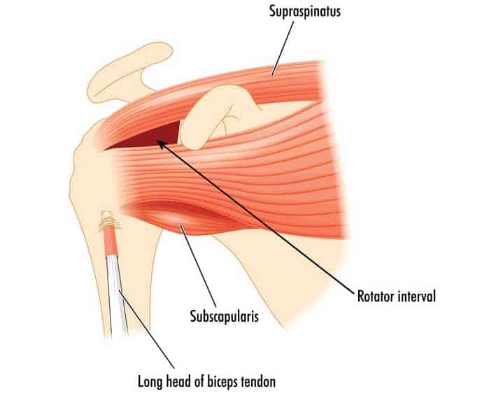 Supraspinatus stretching discount