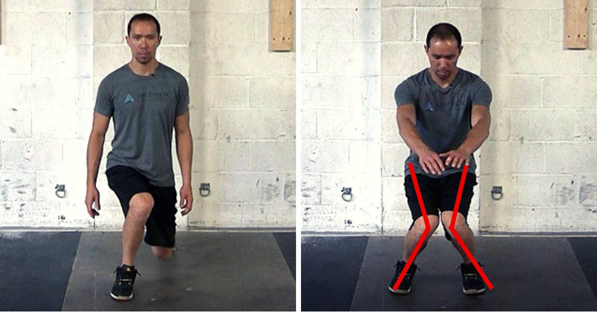 gluteus medius exercises for valgus knees