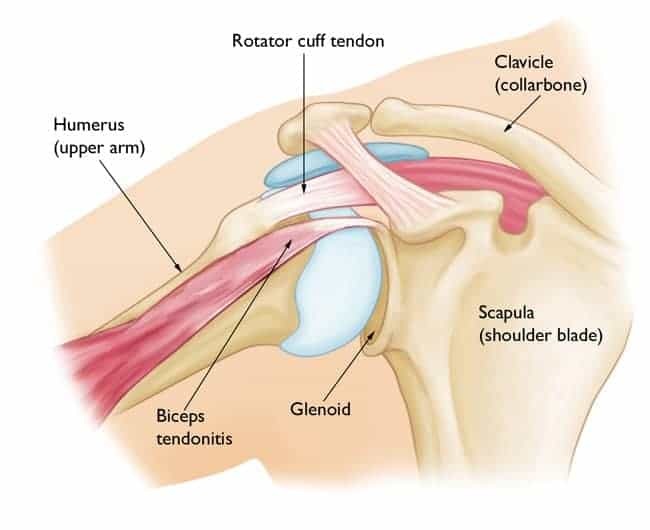 bicep tendonitis anatomy