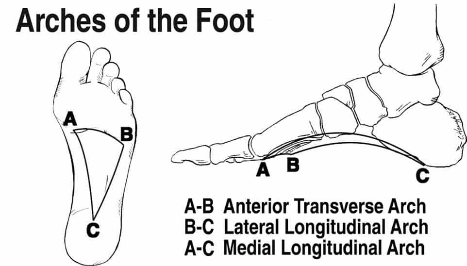 arches of the foot related to plantars fasciitis