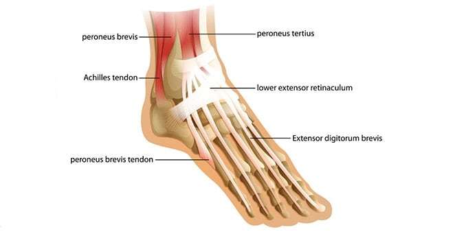 achilles tendon pain