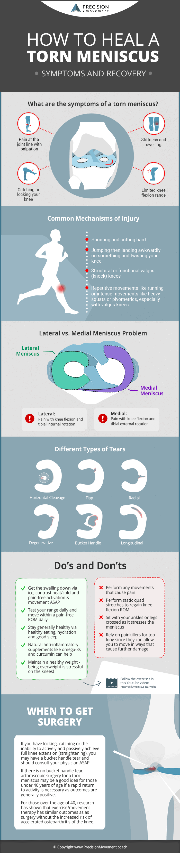 How to Heal a Torn Meniscus Infographic covering: what are the symptoms of a torn meniscus, common mechanisms of injury, lateral vs medial meniscus, different types of tear, do's and dont's, when to get surgery