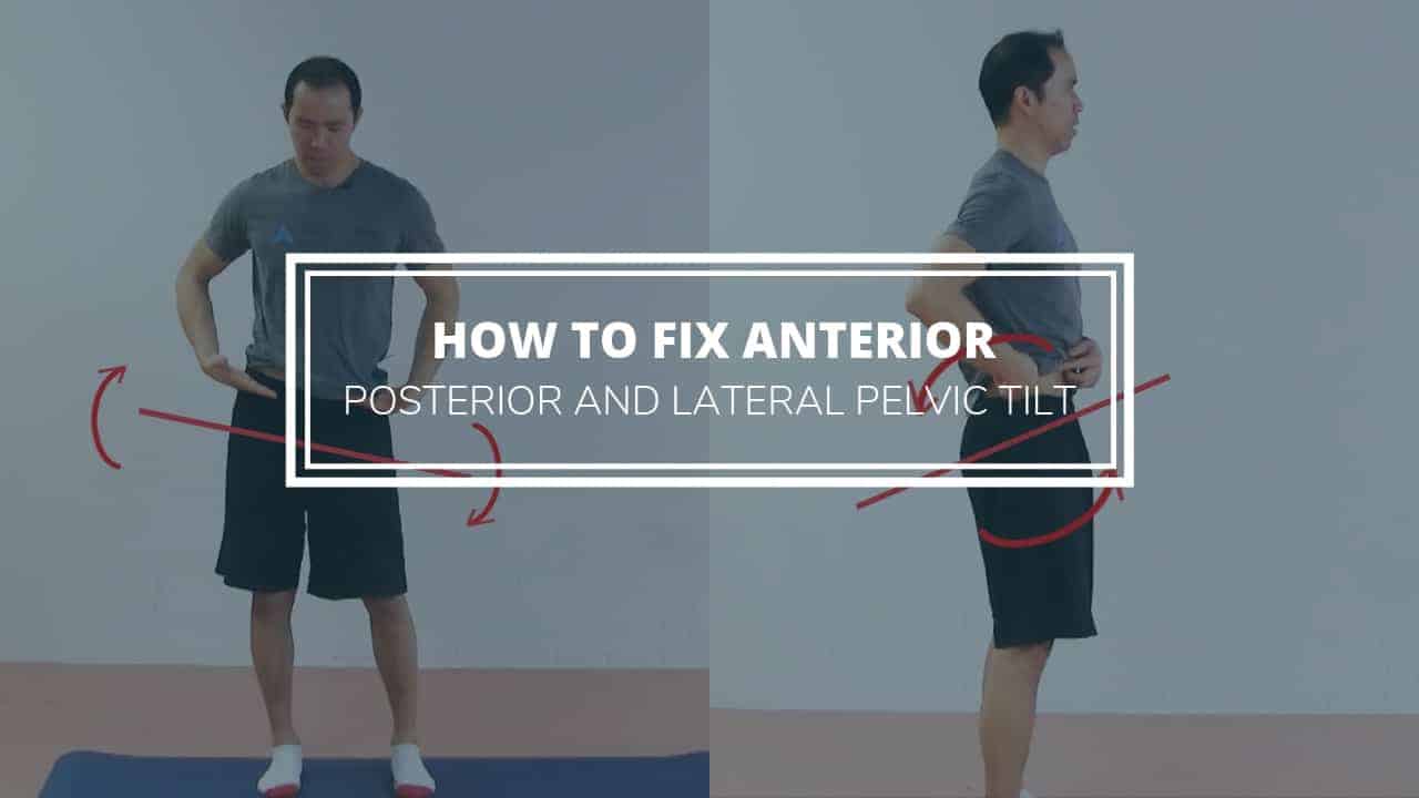 How to fix pelvic tilt - anterior, posterior and lateral tilt posture