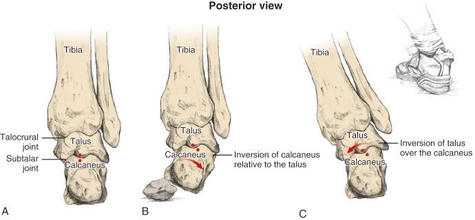 ankle sprains subtalar joint