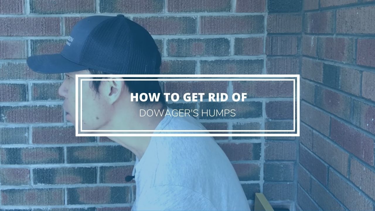 how to get rid of dowagers humps