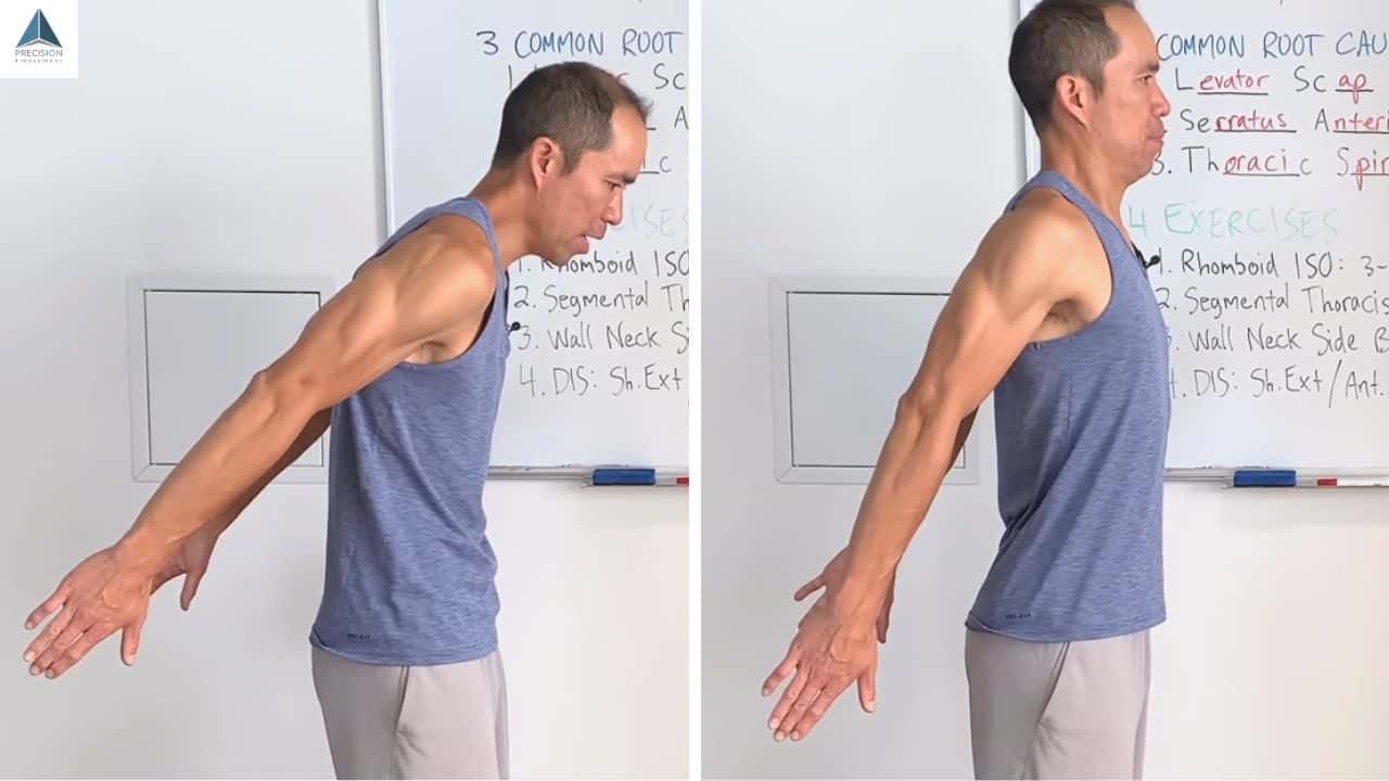 dis shoulder extension