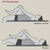 thomas test snapping hip