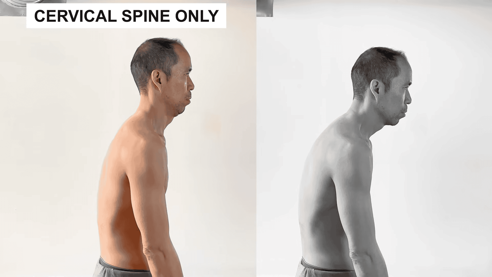cervical spine only