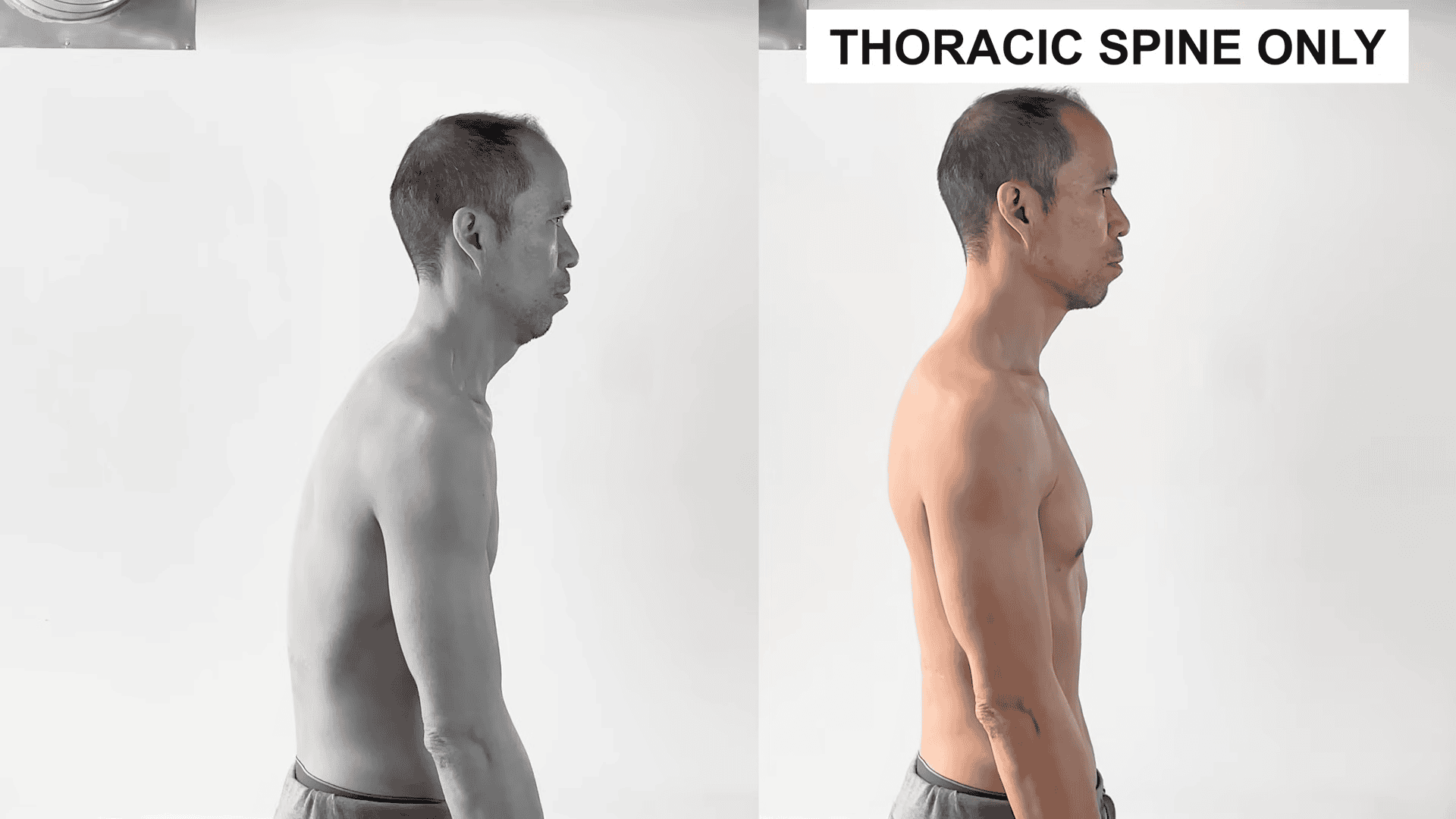thoracic spine only